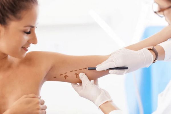 Tiêm botox bắp tay phù hợp với người có bắp tay to do cơ