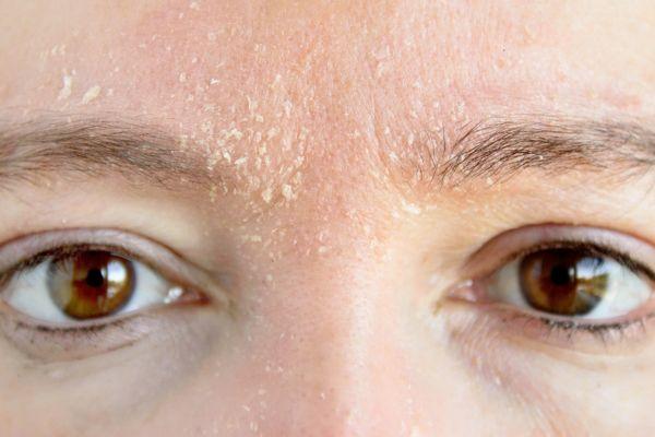 Thời điểm nào thì bạn nên thăm khám bác sĩ sau laser?