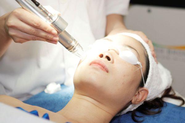 Những công nghệ bắn laser xóa sẹo phổ biến