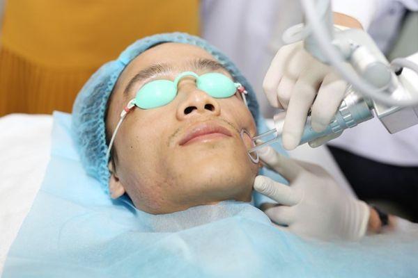 Chăm sóc da sau bắn laser trị sẹo thế nào mới chuẩn?