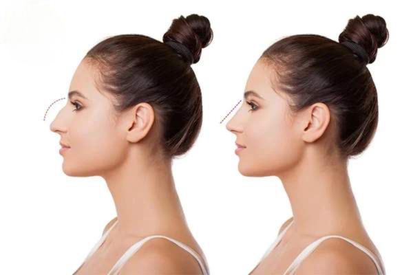 Bao lâu thì vào form tự nhiên