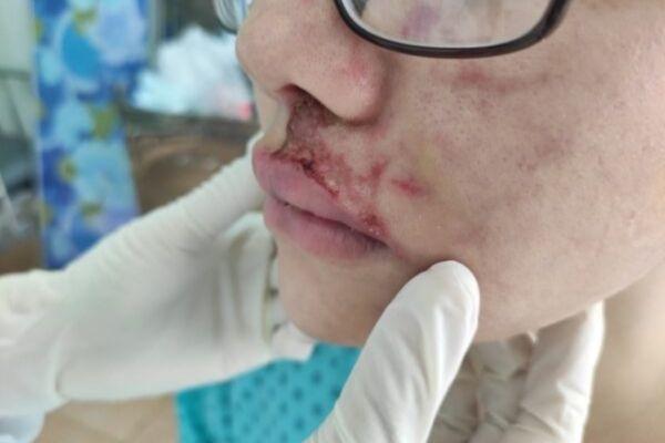 Phân biệt dấu hiệu bình thường và biến chứng sau khi tiêm