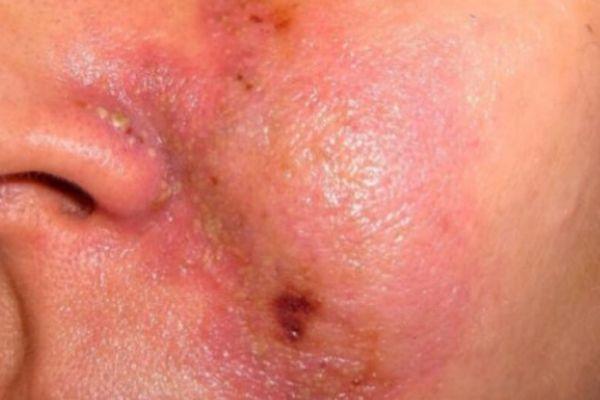 Quy trình thăm khám chuyên sâu giúp đảm bảo an toàn tuyệt đối