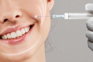 Biến Chứng Tiêm Filler Rãnh Cười: Cách Xử Lý An Toàn Nhất