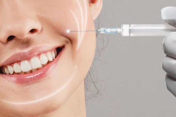 Biến Chứng Tiêm Filler Rãnh Cười: Cách Xử Lý An Toàn Nhất