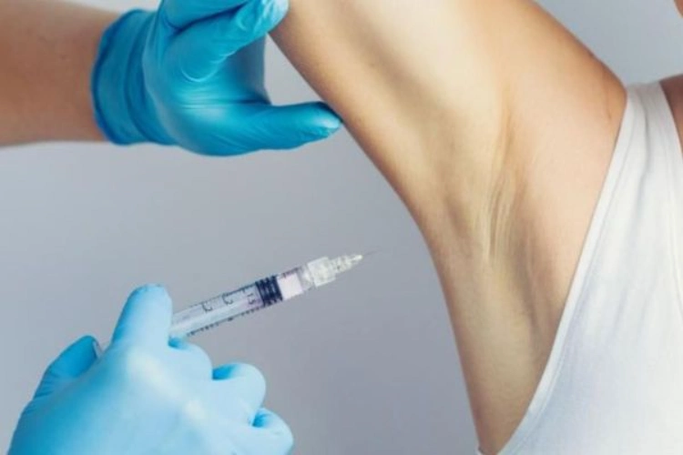 Botox là hoạt chất sinh học giúp kiểm soát mồ hôi nách hiệu quả