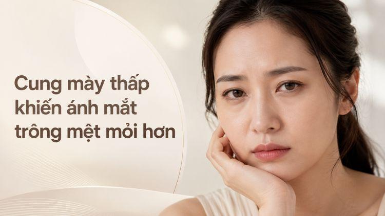 Cung mày thấp khiến ánh mắt trông mệt mỏi hơn