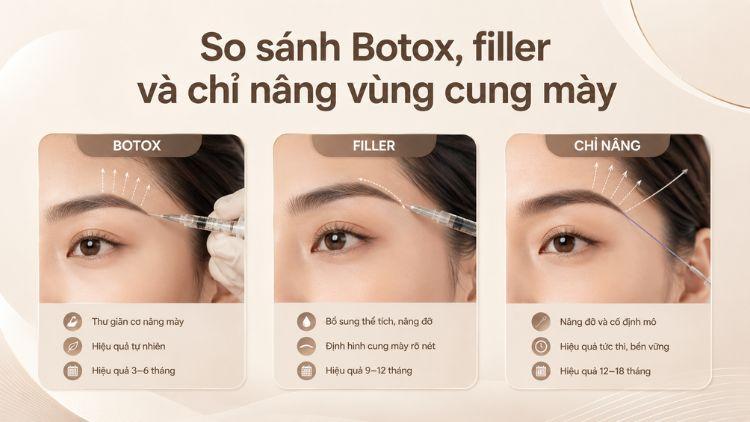 So sánh Botox, filler và chỉ nâng vùng cung mày