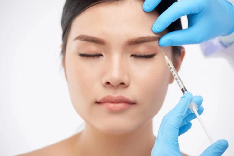 Botox xóa nhăn đuôi mắt giúp làm mờ nếp nhăn quanh mắt an toàn