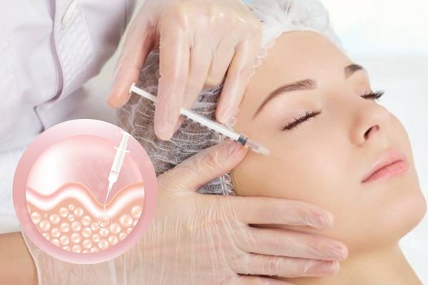 Botox xóa nhăn hoạt động bằng cách ức chế co cơ gây nếp nhăn