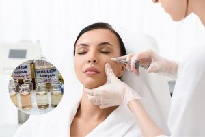 Các loại botox