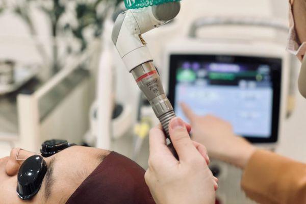 Điều trị sẹo lõm bằng công nghệ Laser