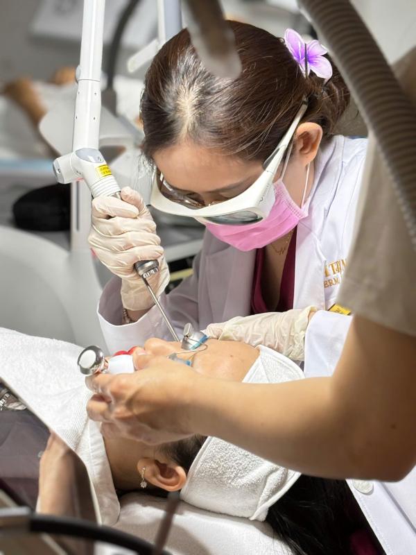 Điều trị sẹo lõm bằng Laser Fotona