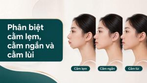 Phân biệt cằm lẹm, cằm ngắn và cằm lùi