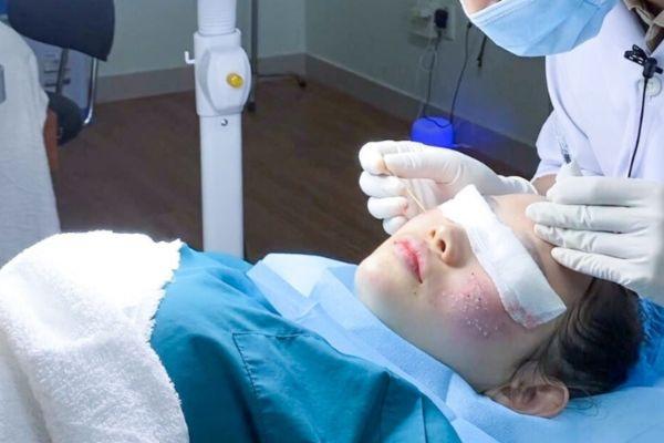 Lý do nên kết hợp TCA với công nghệ điều trị da khác?