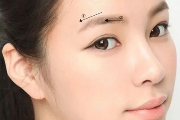Chi phí nâng cung mày trên thị trường thế nào?