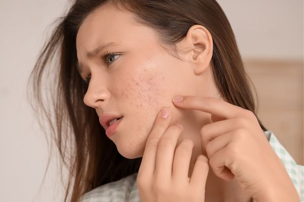 Hậu quả của việc tự nặn mụn bọc tại nhà