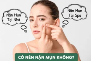 Có nên nặn mụn không