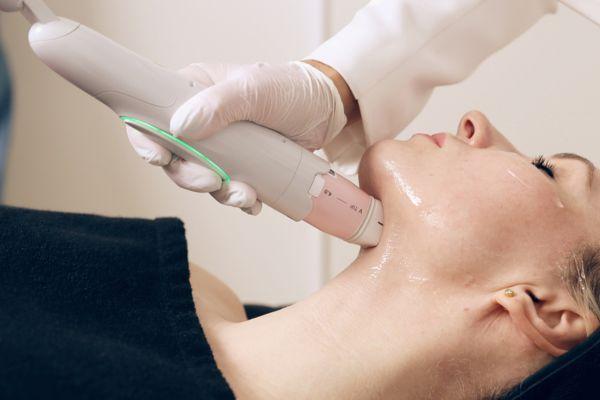 Hiệu quả RF rõ rệt nhưng cần thời gian và liệu trình phù hợp