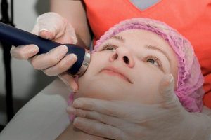 Công nghệ RF là gì? Giải pháp nâng cơ trẻ hóa da an toàn