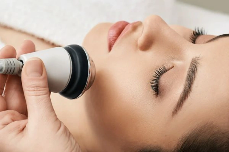 RF là công nghệ sóng cao tần không xâm lấn giúp nâng cơ mặt an toàn