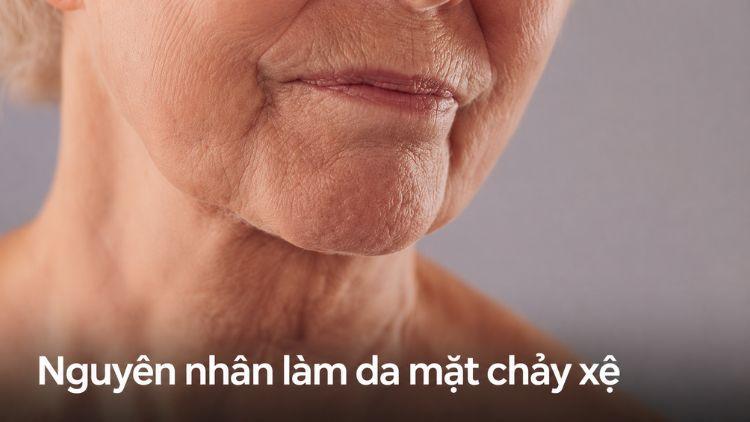 Ánh nắng và lão hóa làm collagen da suy giảm nhanh