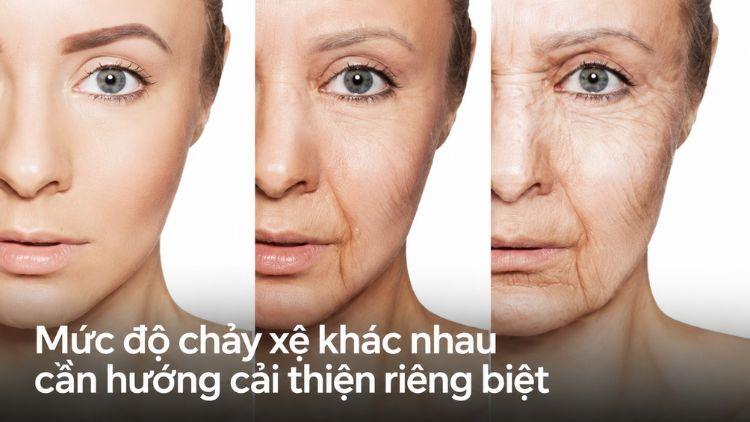 Mức độ chảy xệ khác nhau cần hướng cải thiện riêng biệt