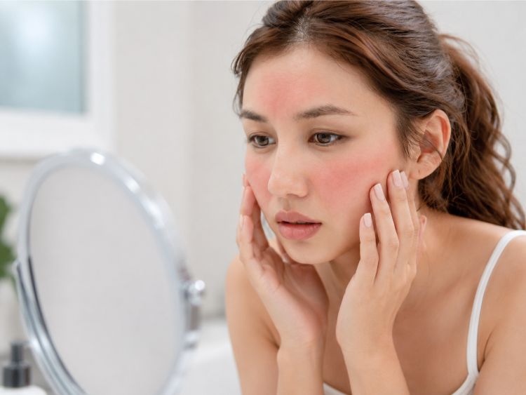 Da nhạy cảm cần được ổn định trước khi cân nhắc can thiệp chuyên sâu