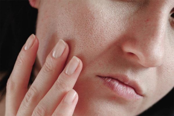 Xác định mức độ da sần vỏ cam giúp cải thiện đúng cách và hiệu quả
