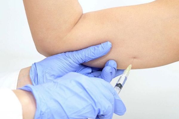 Citrine Derma Clinic là địa chỉ tiêm botox bắp tay uy tín tại TPHCM