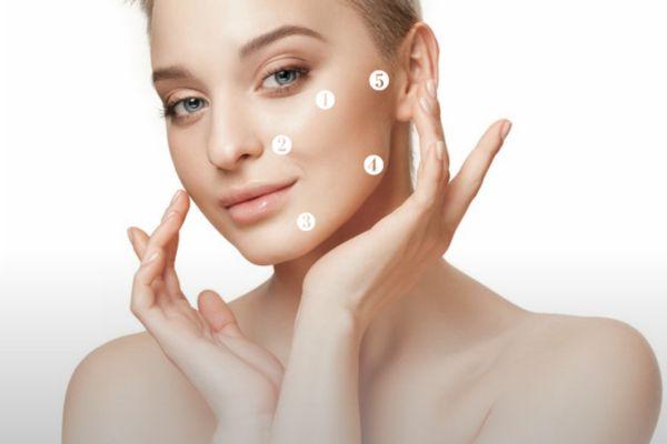 5 điểm tiêm BAP Profhilo giúp lan tỏa HA đều toàn khuôn mặt