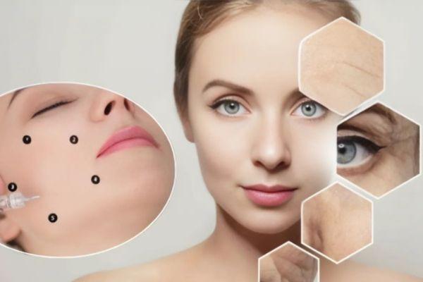 Profhilo phù hợp người lão hóa sớm cần cấp ẩm và săn chắc da