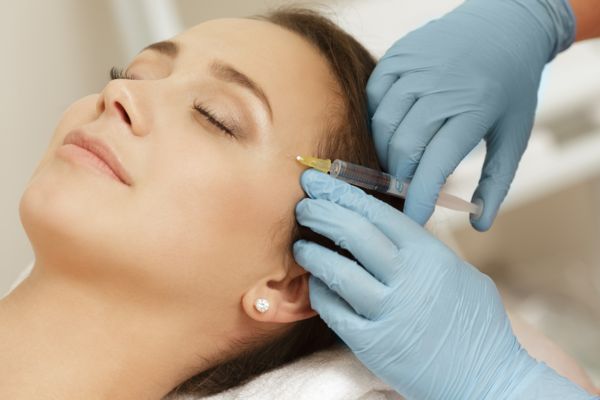 Filler PMMA là chất làm đầy bán vĩnh viễn giúp cải thiện nếp nhăn sâu và sẹo lõm