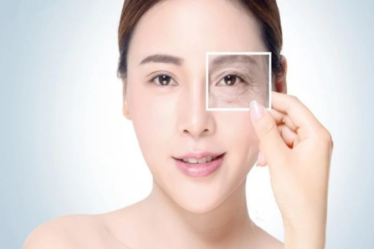 Botox xóa nhăn đuôi mắt cho hiệu quả sau vài ngày và duy trì từ 3–6 tháng