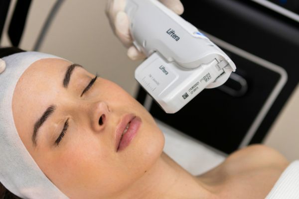 HIFU nâng cơ, kích thích collagen, cải thiện da chùng và nếp nhăn nhẹ