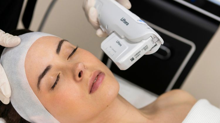 HIFU Liftera phù hợp với da chùng nhẹ và đường viền mặt kém rõ