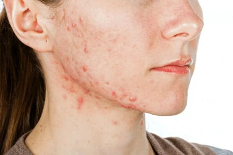 Hướng dẫn chăm sóc da chi tiết từ trong ra ngoài