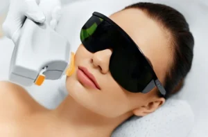 ipl trị mụn là gì