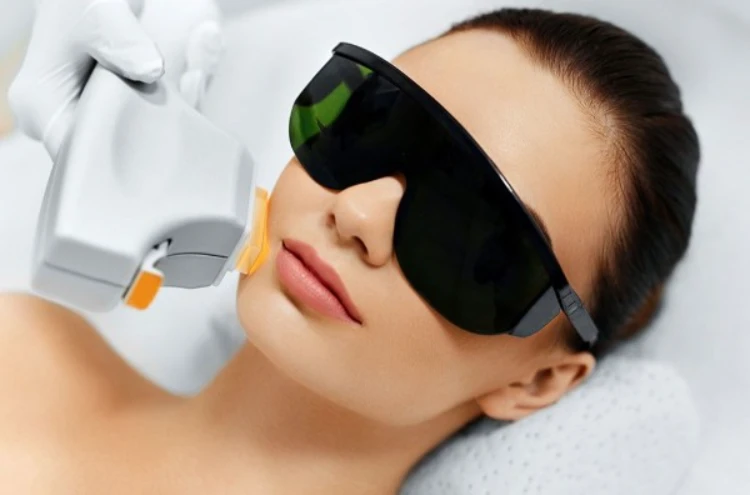 ipl trị mụn là gì