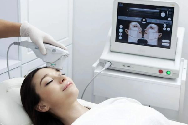 Ultherapy đau hơn nhưng nâng cơ sâu; HIFU nhẹ nhàng, ít khó chịu hơn
