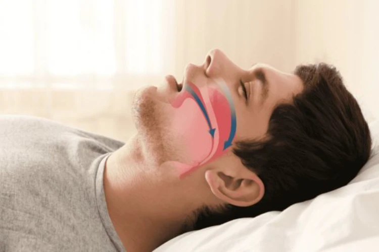 Nên thăm khám sớm nếu ngủ ngáy kèm ngưng thở và mệt mỏi kéo dài