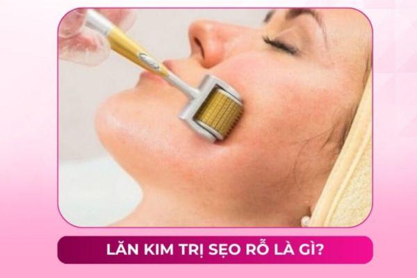Giới thiệu sơ lược về phương pháp lăn kim điều trị sẹo
