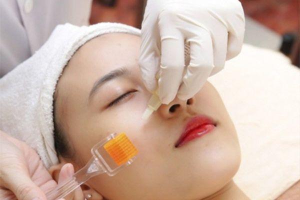 Giá trị sẹo bằng phương pháp lăn kim để bạn tham khảo
