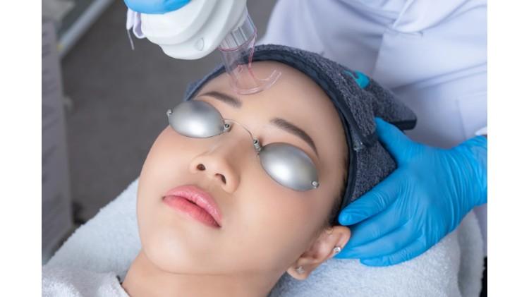 Laser Fractional CO2 giải pháp xóa sổ sẹo rỗ, trẻ hóa da