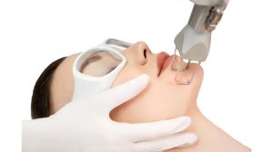 Laser CO2 Fractional: Đột phá trong trị sẹo rỗ và trẻ hóa da