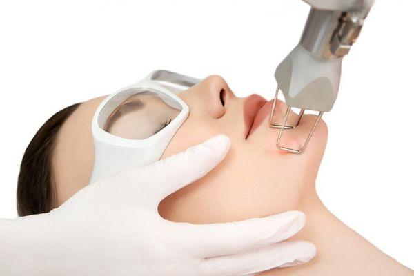 Tìm hiểu sự khác biệt của Laser Pico và Laser CO2
