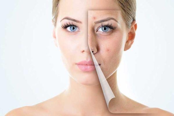 Liệu trình tái tạo da là lộ trình phục hồi chuyên sâu, cá nhân hóa