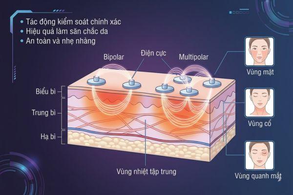 RF lưỡng cực/đa cực tác động nông–trung bình, phù hợp chăm sóc duy trì