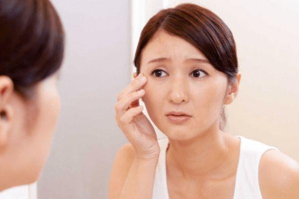 Sóng RF phù hợp người lão hóa nhẹ muốn nâng cơ không xâm lấn