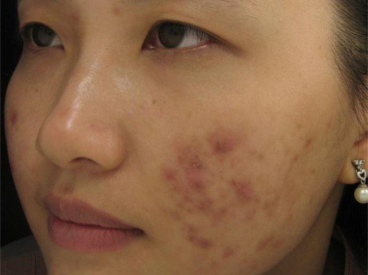Một vùng da có thể đồng thời đổi màu và thay đổi cấu trúc